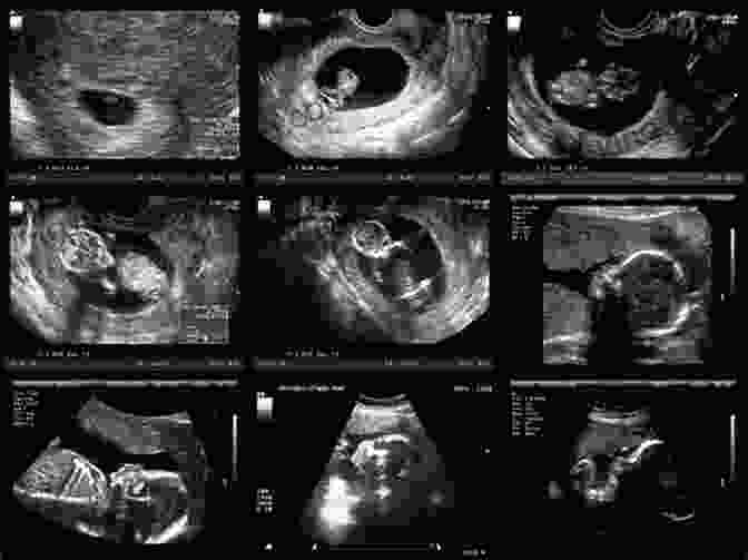 Ultrasound Image Of A Developing Baby Dad S Guide To Pregnancy For Dummies